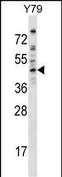 EPB49 Antibody (Center)