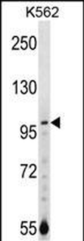 NARG1 Antibody (N-term)