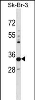 PHYHD1 Antibody (C-term)