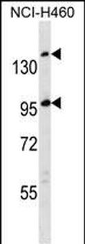 SSC5D Antibody (Center)