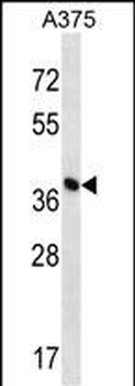 DPH1 Antibody (C-term)