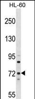 MTMR6 Antibody (N-term)