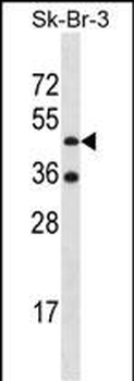 ETNK2 Antibody (N-term)