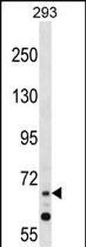 ZNF214 Antibody (N-term)