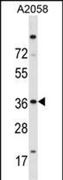 ISL2 Antibody (N-term)