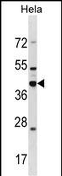 DND1 Antibody (Center)