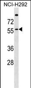 ZDHHC13 Antibody (N-term)