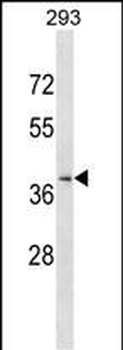 CCRL2 Antibody (Center)