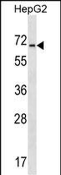 ACCN4 Antibody (N-term)