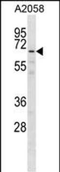 GPKOW Antibody (Center)