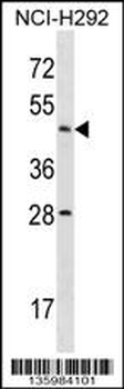 ACTL7B Antibody (N-term)