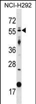 GLIS2 Antibody (Center)