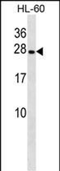 PGRMC2 Antibody (C-term)