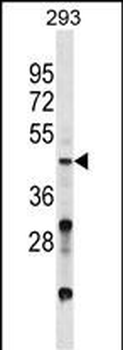 VSX2 Antibody (C-term)