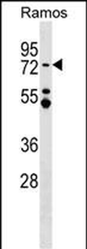 MTA3 Antibody (C-term)