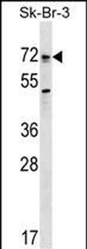 Mouse Bmpr1a Antibody (Center)
