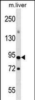CXXC1 Antibody (Center)