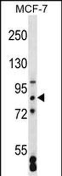 SATB2 Antibody (Center)