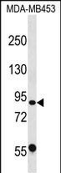 CAPN13 Antibody (C-term)