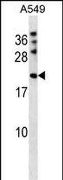 MPHOSPH6 Antibody (N-term)