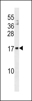 MANF Antibody (N-term)
