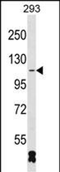 RBM26 Antibody (N-term)