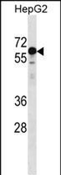KLHL25 Antibody (N-term)