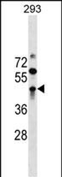 ZBTB32 Antibody (N-term)