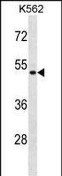 ENOSF1 Antibody (N-term)