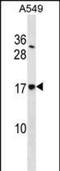 SSR4 Antibody (Center)