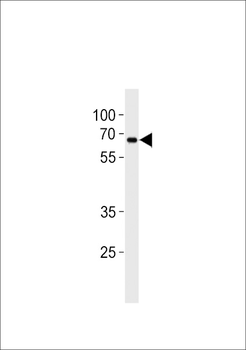 ZNF90 Antibody (Center)