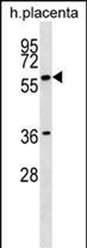 GAB3 Antibody (N-term)