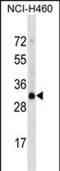 OR4D2 Antibody (C-term)