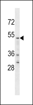 YTHD2 Antibody (C-term)