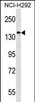 DLGAP4 Antibody (N-term)