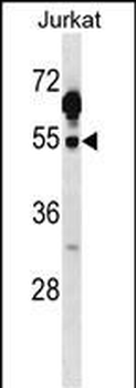 Mouse Csk Antibody (C-term)