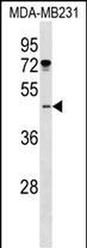 ISL1 Antibody (Center)
