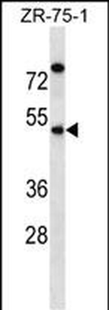 EME2 Antibody (C-term)