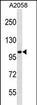 CCDC46 Antibody (N-term)