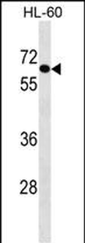 AIM1L Antibody (C-term)