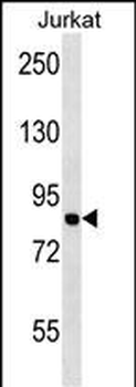 MCM7 Antibody (N-term)