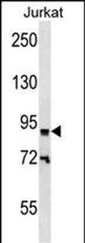 ZNF780B Antibody (N-term)
