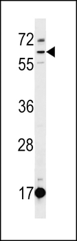 DEPDC1B Antibody (C-term)