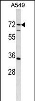 CDADC1 Antibody (C-term)