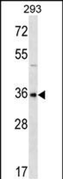 GBX1 Antibody (Center)