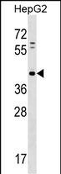 PAP2D Antibody (Center)