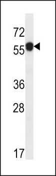 ARMT1 Antibody (N-term)