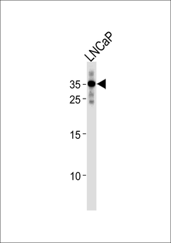 RNF4 Antibody (C-term)