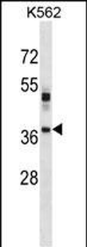 VSX1 Antibody (Center)