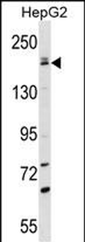 PNPLA6 Antibody (C-term)